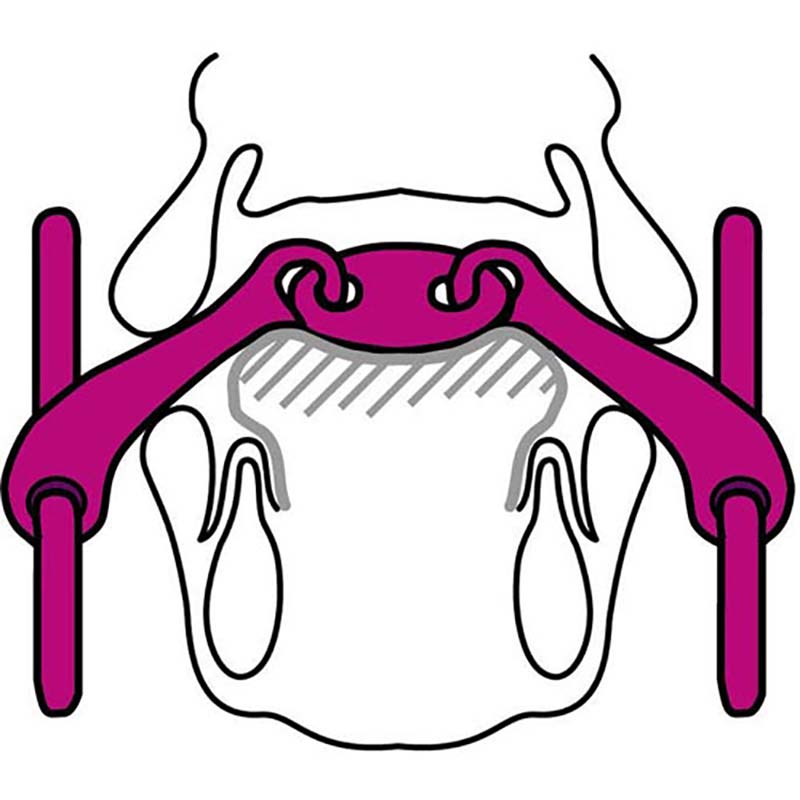 Sprenger snaffle bit aurigan 40226 - 2477